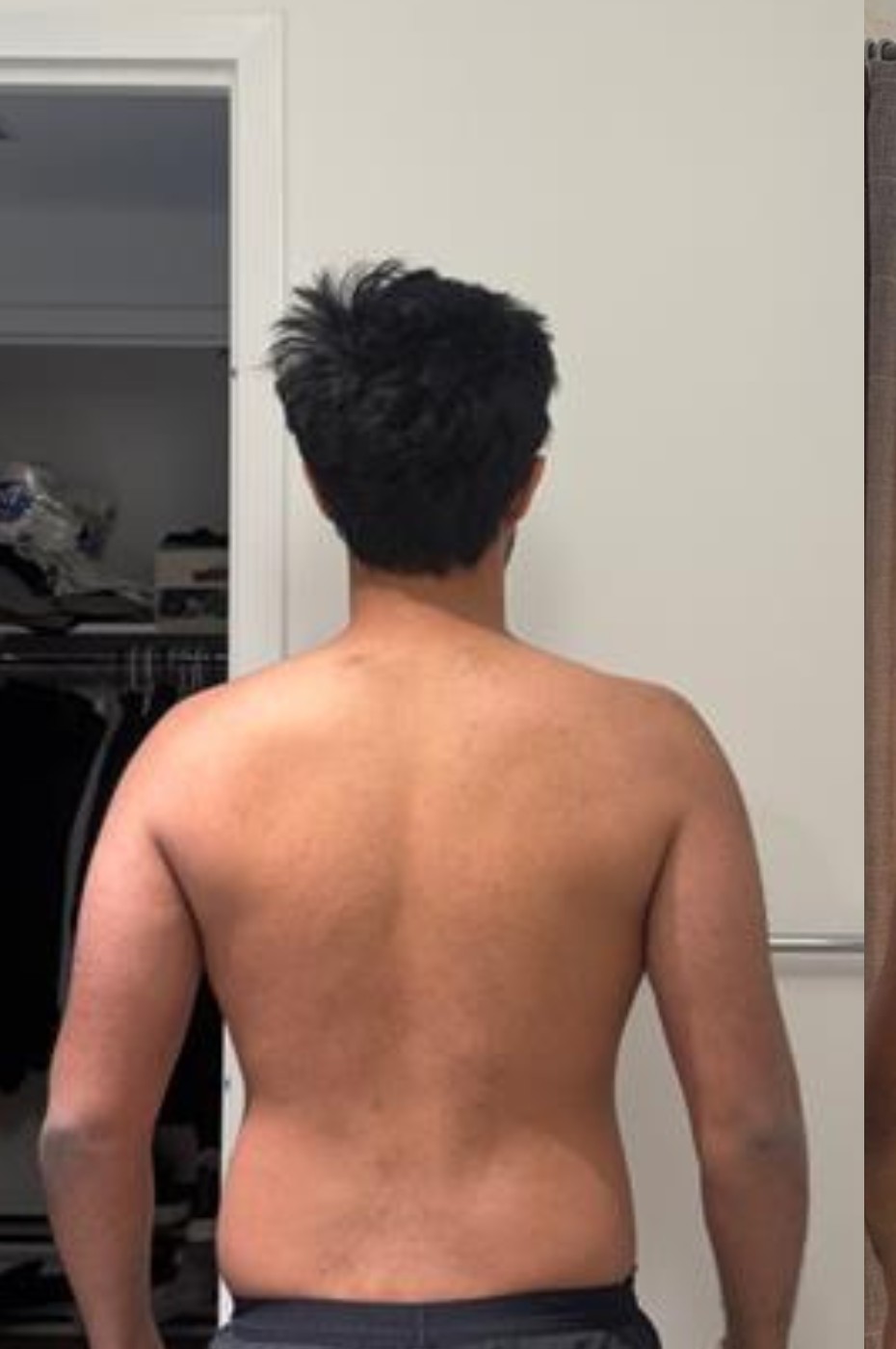 Aaryomaan B. before
