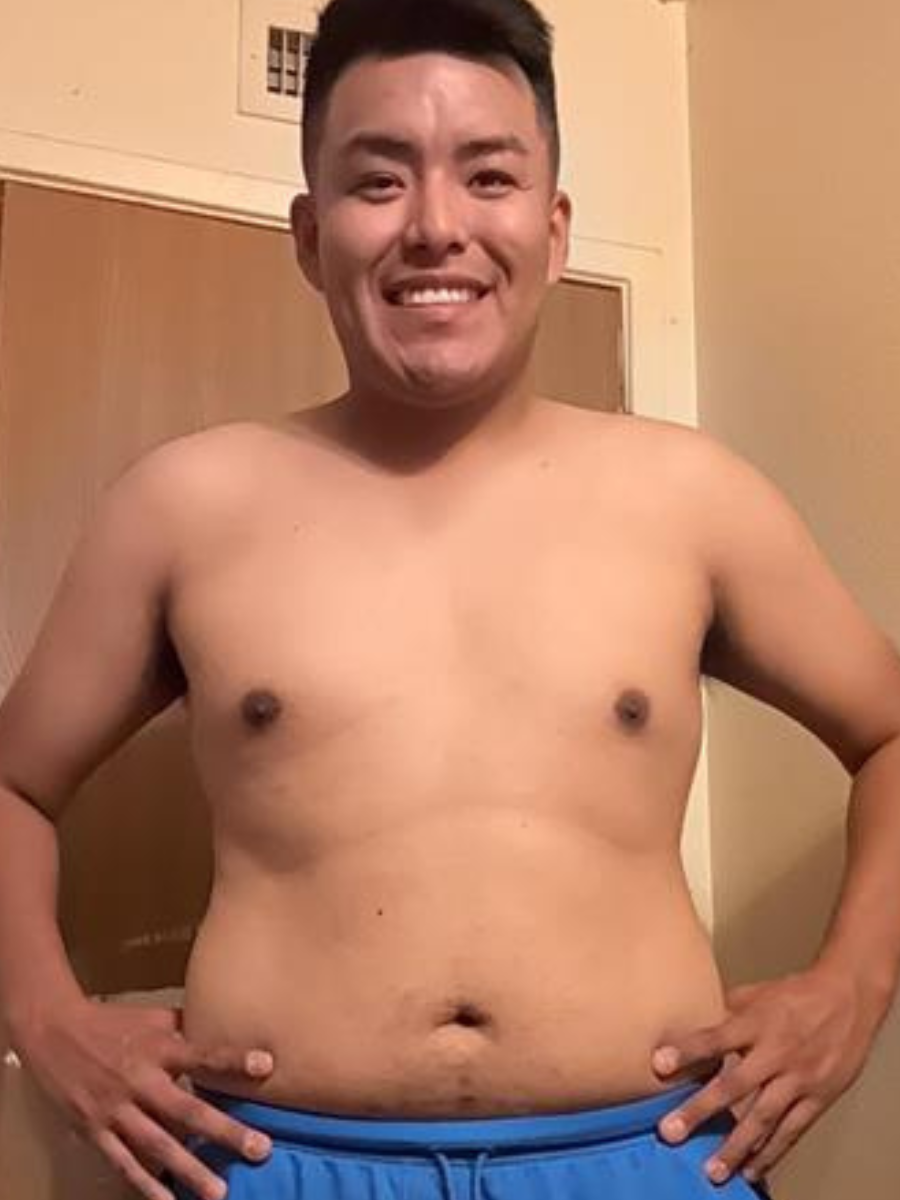 Brad L. before