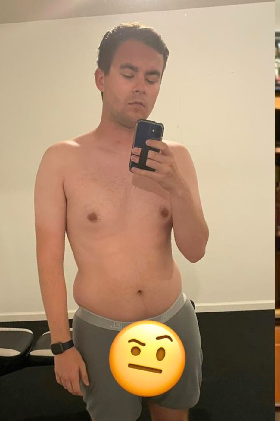 Brady M. before